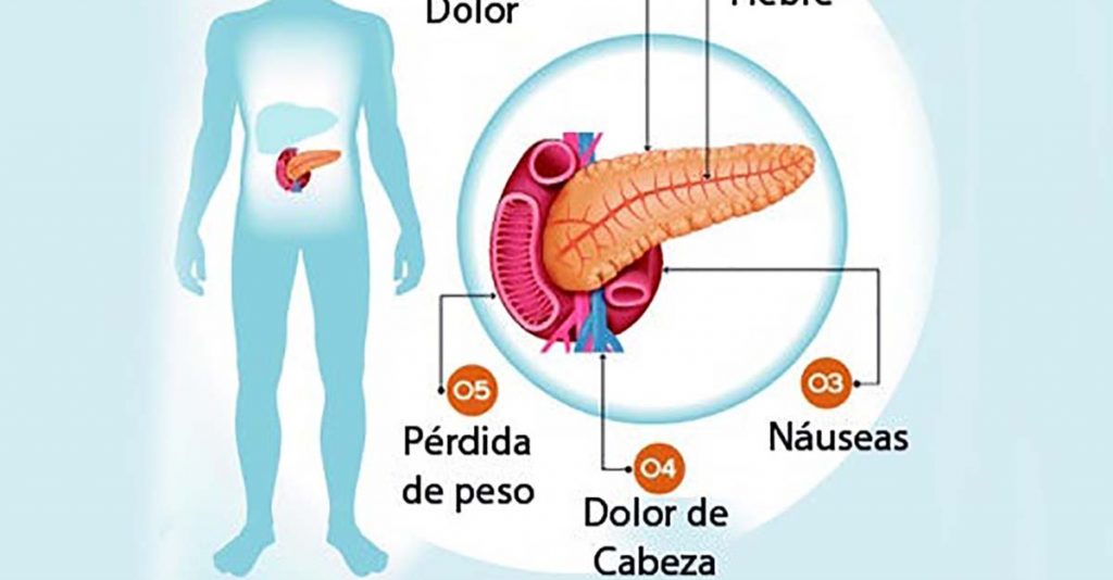 6 Síntomas Que Indican Problemas En Tu Páncreas | Delicias Blog