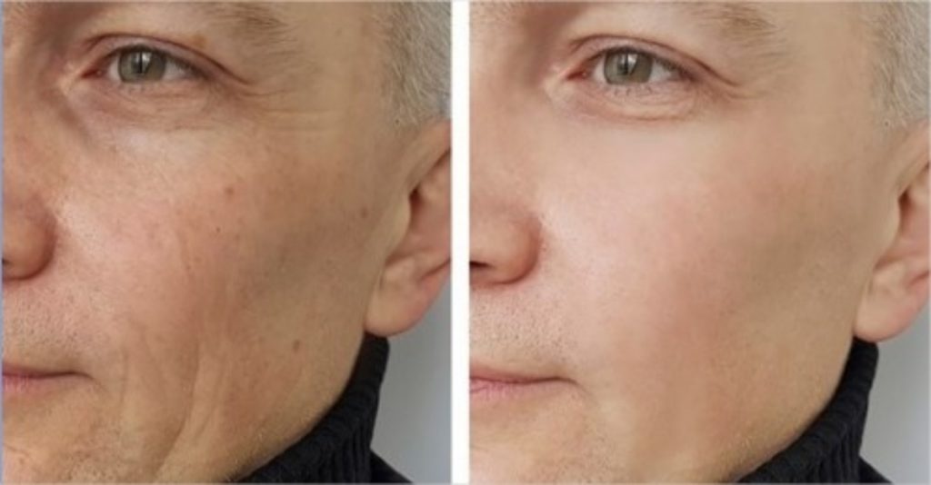 Conoce La Autofagia Y Cómo Puedes Ayudar A Tu Cuerpo A Rejuvenecer Tus ...